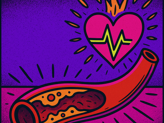 Oltre il Colesterolo “Cattivo”:Una Nuova Comprensione del Rischio Cardiovascolare