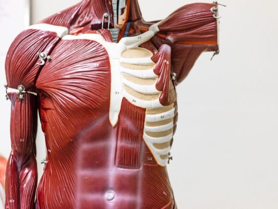 Il Grasso che Infiltra i Muscoli — Il Segreto della Sarco-Obesità e il Tumore al Seno